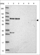 Anti-SAMD1 Antibody
