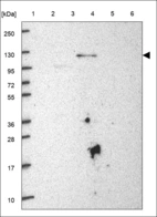 Anti-ZSWIM6 Antibody