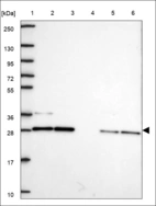 Anti-NIPA1 Antibody