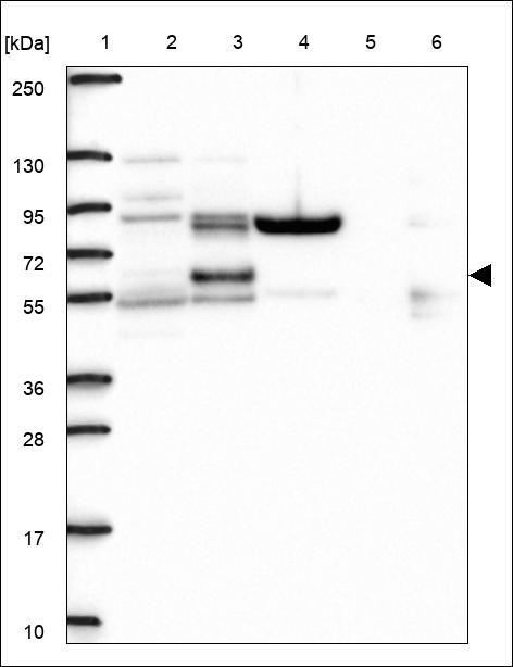 Anti-OTUD5 Antibody