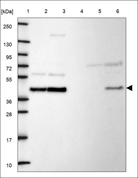 Anti-UBR7 Antibody