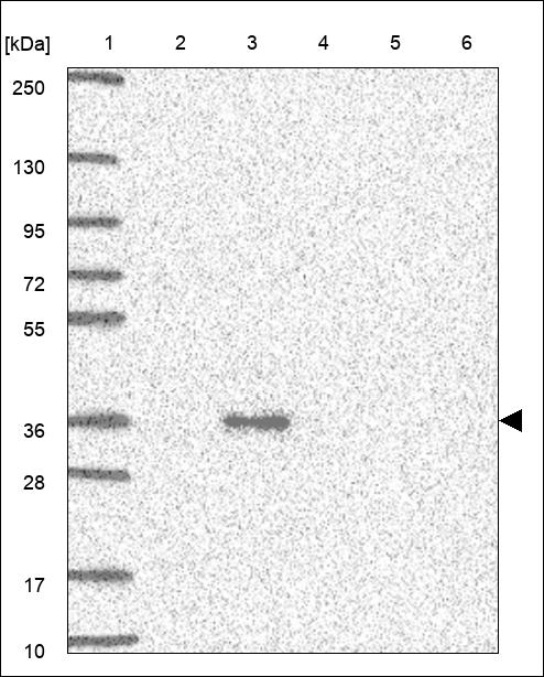 Anti-ASB1 Antibody
