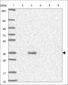 Anti-ASB1 Antibody