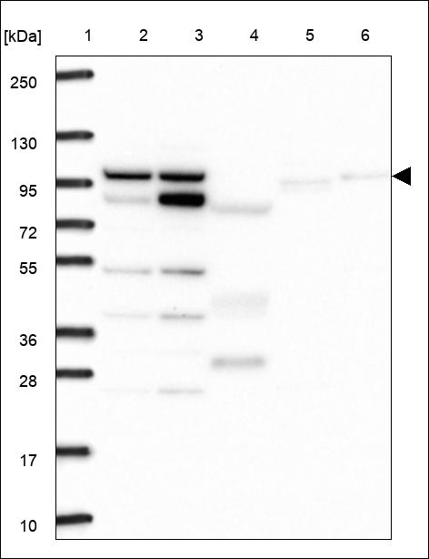 Anti-ZNF33A Antibody