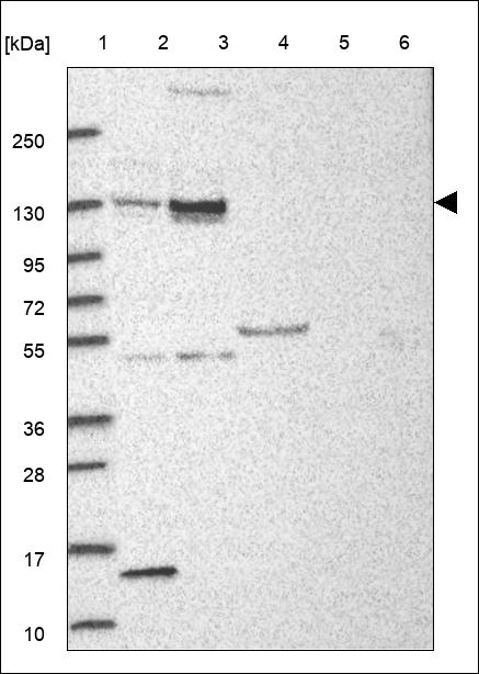 Anti-ASXL1 Antibody