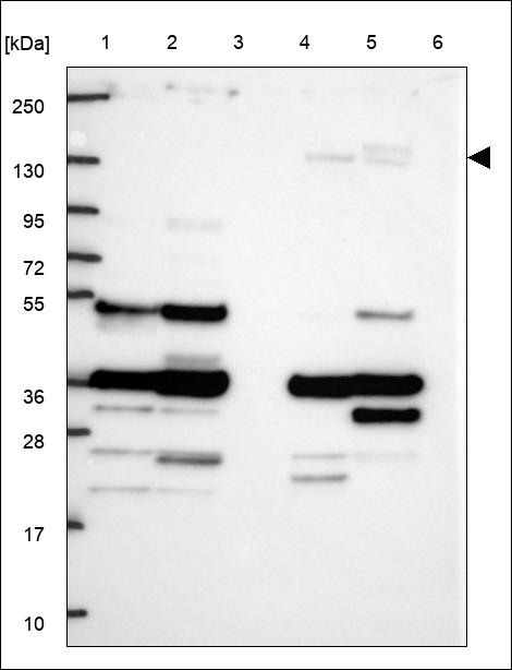 Anti-KDM6B Antibody