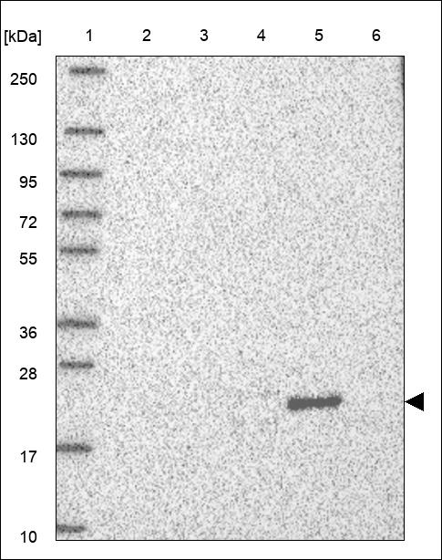 Anti-FTH1 Antibody