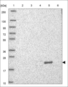 Anti-FTH1 Antibody