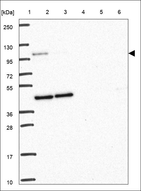 Anti-VPS53 Antibody