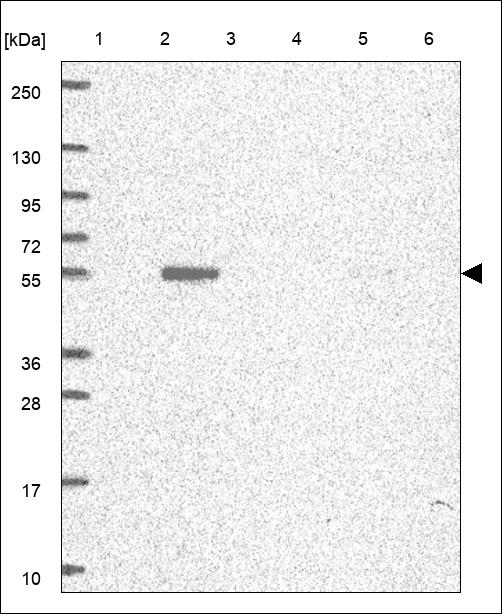 Anti-STK26 Antibody