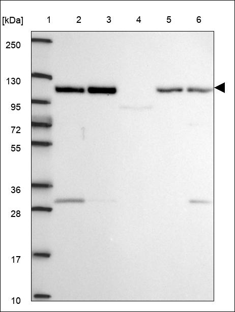 Anti-CCDC80 Antibody