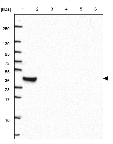 Anti-HCAR3 Antibody