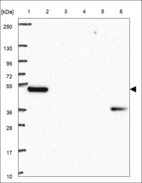 Anti-ZNF426 Antibody
