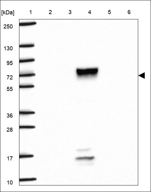 Anti-SERPINF2 Antibody