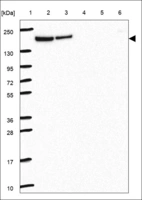 Anti-SOS1 Antibody