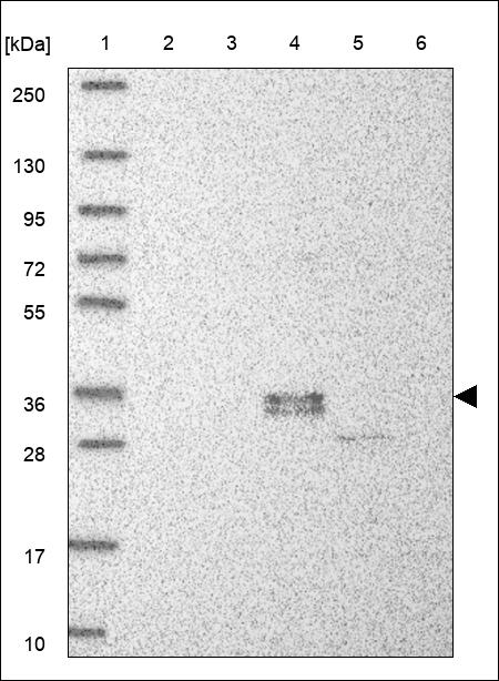 Anti-TRIB1 Antibody