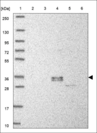 Anti-TRIB1 Antibody