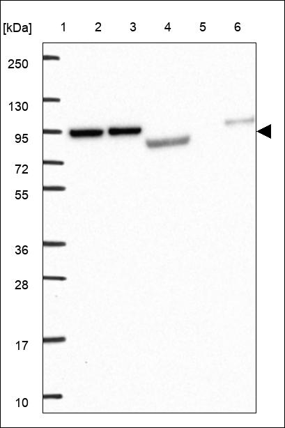 Anti-TCAF1 Antibody