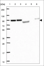 Anti-TCAF1 Antibody