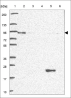 Anti-ALDH16A1 Antibody
