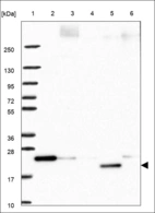 Anti-DCTPP1 Antibody