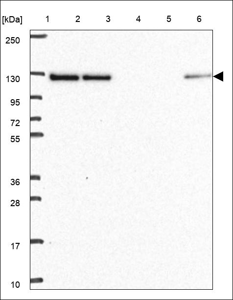 Anti-UBE3C Antibody