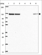 Anti-UBE3C Antibody