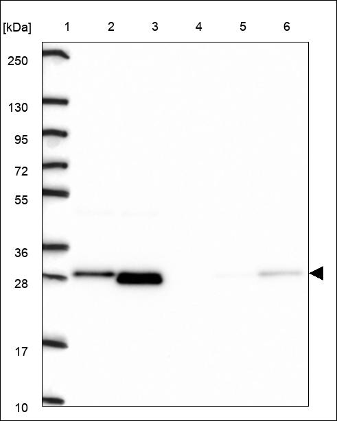 Anti-UCHL3 Antibody