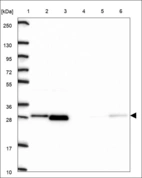 Anti-UCHL3 Antibody