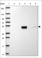Anti-SERPINF1 Antibody