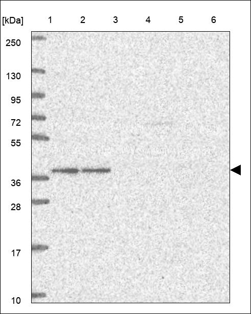 Anti-HMG20B Antibody