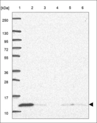 Anti-TIMM13 Antibody