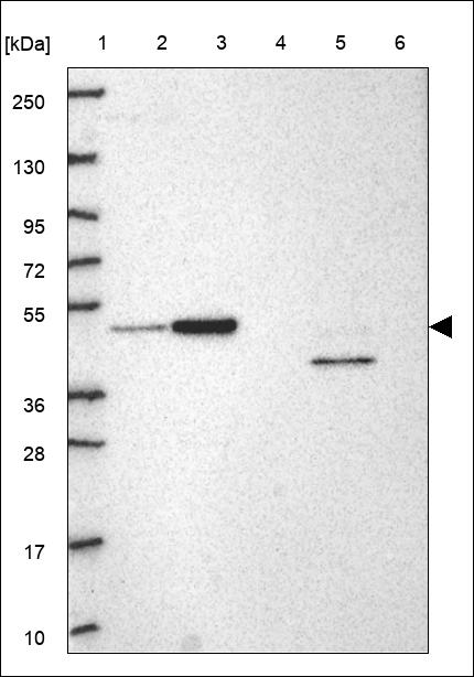 Anti-POLL Antibody