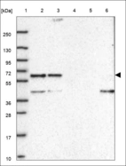 Anti-ANTXR2 Antibody