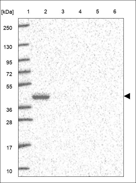 Anti-RCL1 Antibody