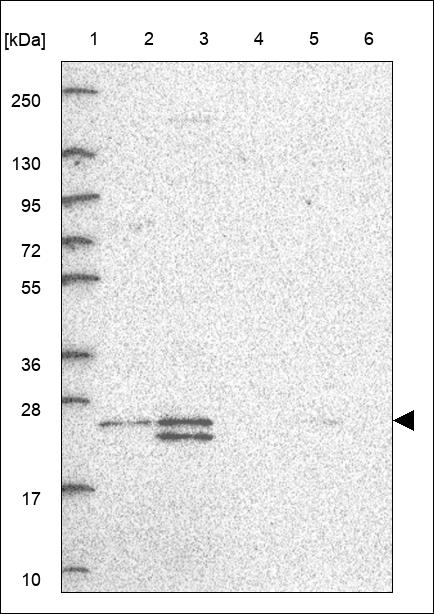 Anti-ZCRB1 Antibody