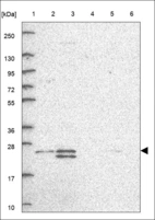 Anti-ZCRB1 Antibody