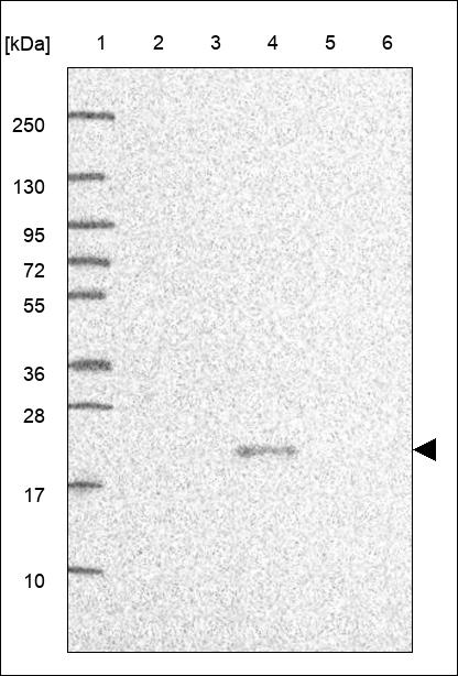 Anti-CCDC71L Antibody