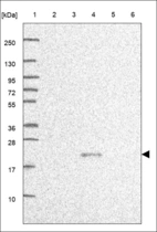 Anti-CCDC71L Antibody