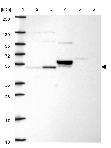Anti-WSB2 Antibody