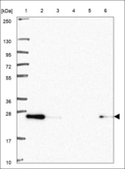 Anti-TLE5 Antibody