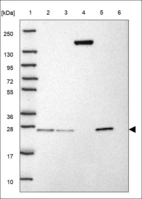 Anti-CFHR3 Antibody