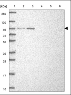 Anti-TLE3 Antibody