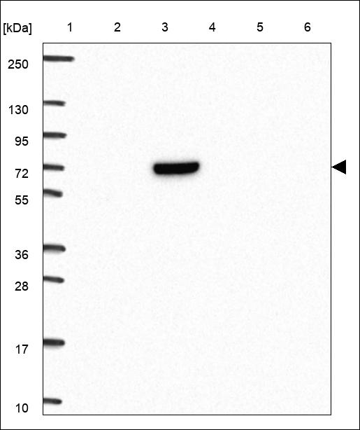 Anti-C8A Antibody