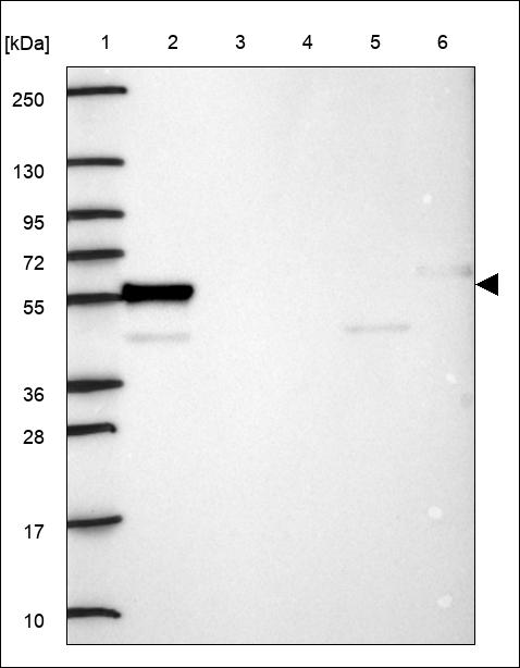 Anti-L2HGDH Antibody