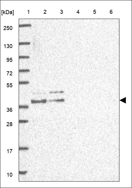 Anti-WNT5A Antibody
