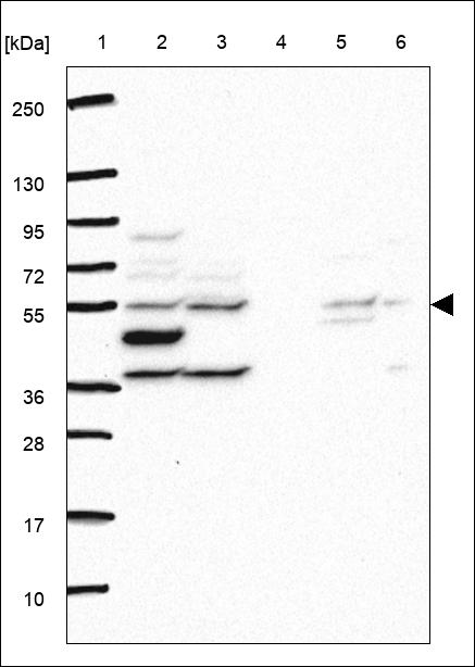 Anti-RNPC3 Antibody