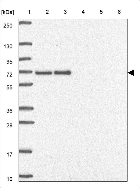 Anti-POT1 Antibody