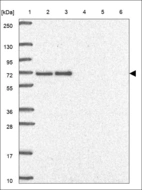 Anti-POT1 Antibody