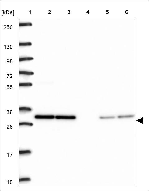 Anti-MED20 Antibody